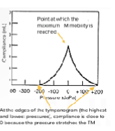 <p><span>observed in an individual with normal middle</span><br><span>ear pressure</span></p><p><span>normal hearing ,sensorineural hearing loss</span></p>