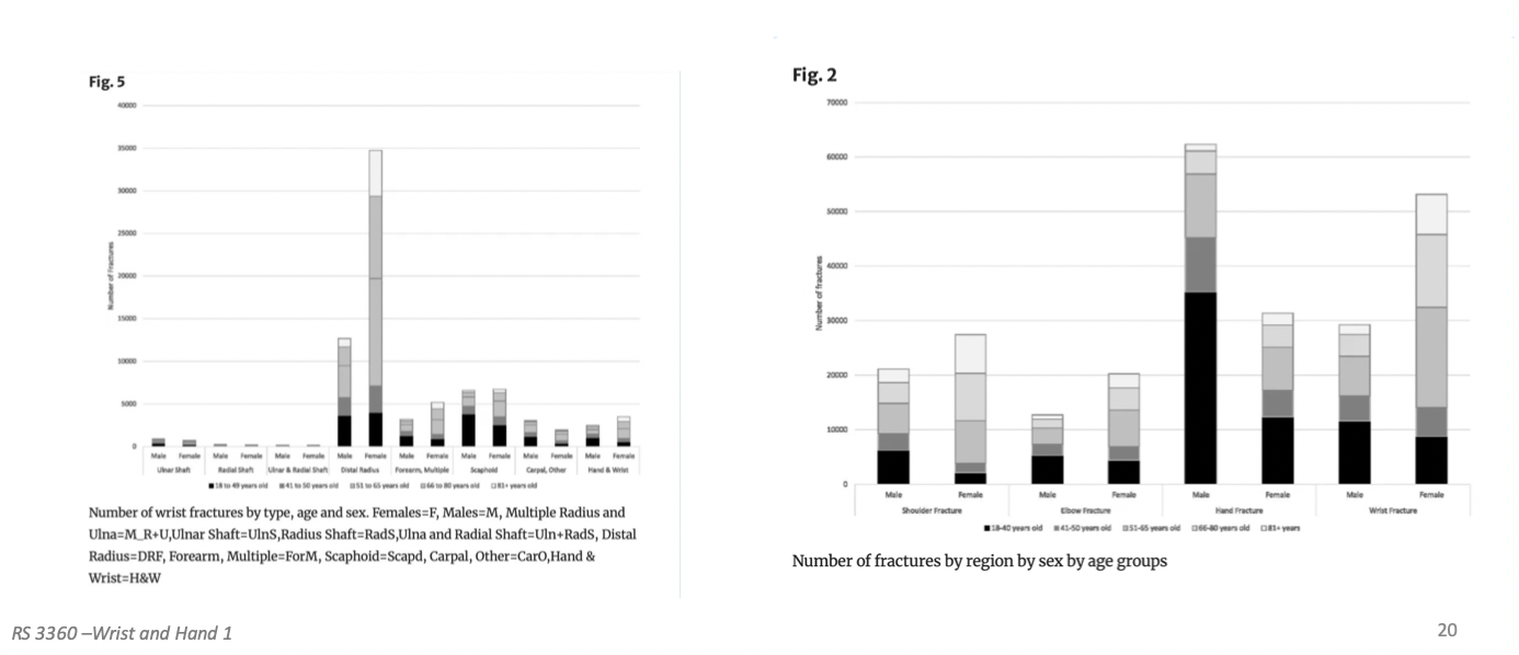 <p>• One of the most common upper extremity injuries</p><p>*administrative health from all the hospitals in Ontario- common reasons ppl go to the hospital to receive treatment, the # of fractures in diff age groups</p><p>*most common fracture is distal radius- much more common in females than males</p><p>-osteoporosis</p><p>50 year olds still up and active, hiking, more opportunity to fall</p><p>hyperextension of wrist, distal radius takes on all the load</p><p></p><p>males- 18-40- punch a wall or fight or play sports</p>