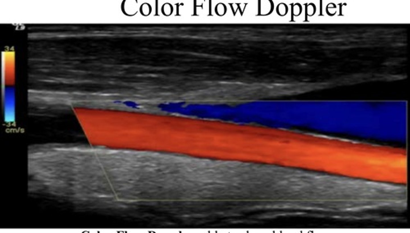 <p>Able to show blood flow motion in a selected two dimensional area. Direction in velocity blood flow are color-coded and superimposed on the corresponding B mode image</p>
