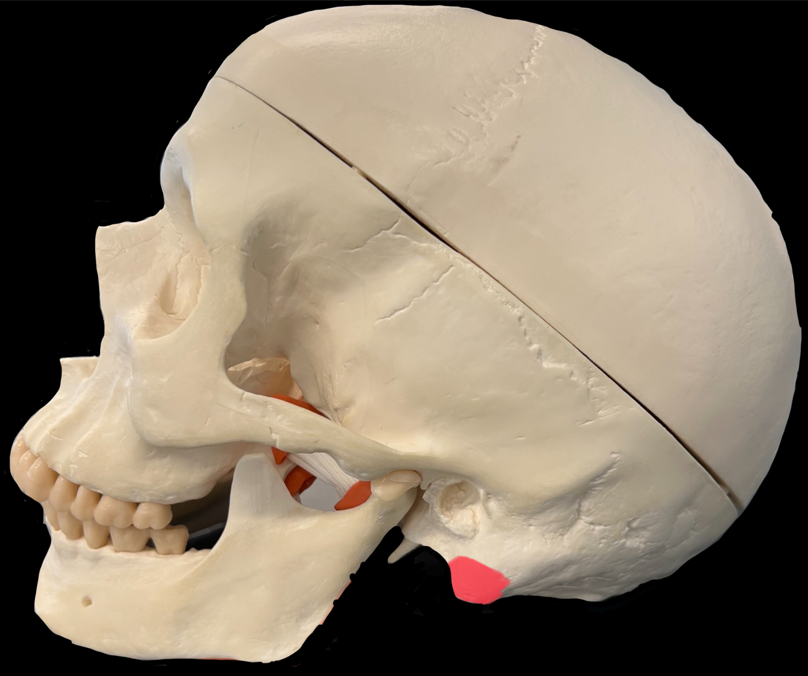 What is highlighted in red?

Give a muscle that inserts here.