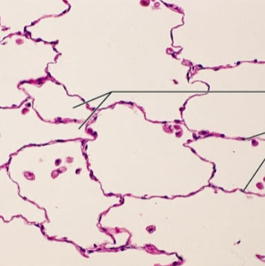<p><strong>what is the epithelia?</strong></p>