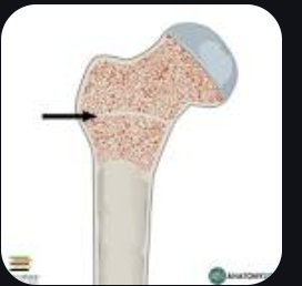 <p>Epiphyseal Plate</p>