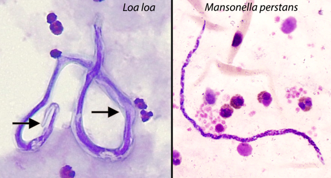 <p>Mansonella perstans</p><p>GD</p><p>v/IS</p>