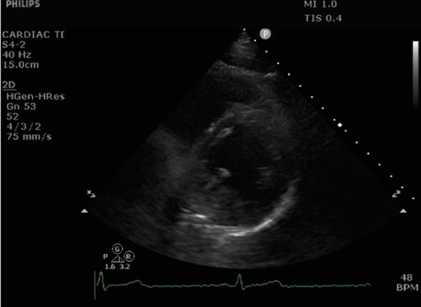 <p>What view of the heart is this?</p>