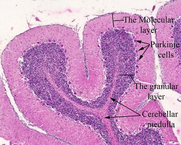 <p>The depicted microscopic slide shows a _______</p>