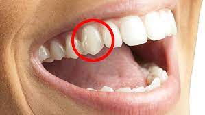 <p>Canines (also known as “cuspids”)</p>