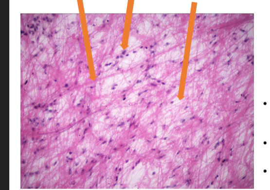 <p>what tissue is this</p>