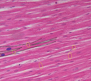 <p>Cardiac muscle</p>