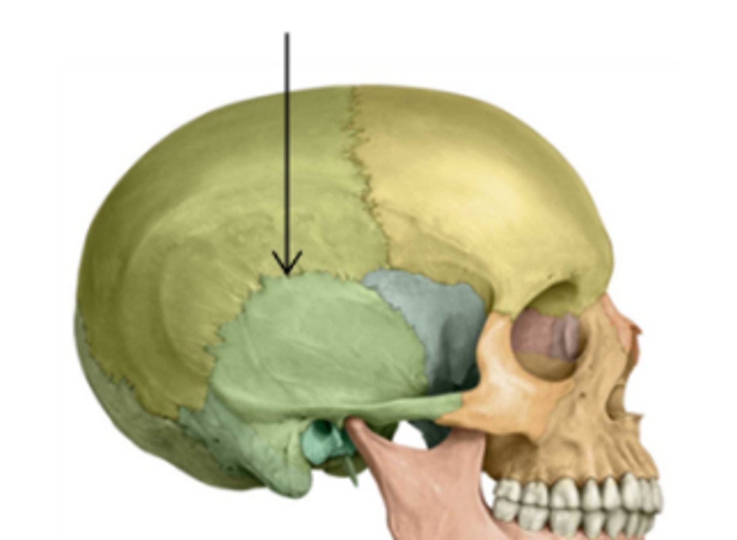 <p>between temporal and parietal bones</p>