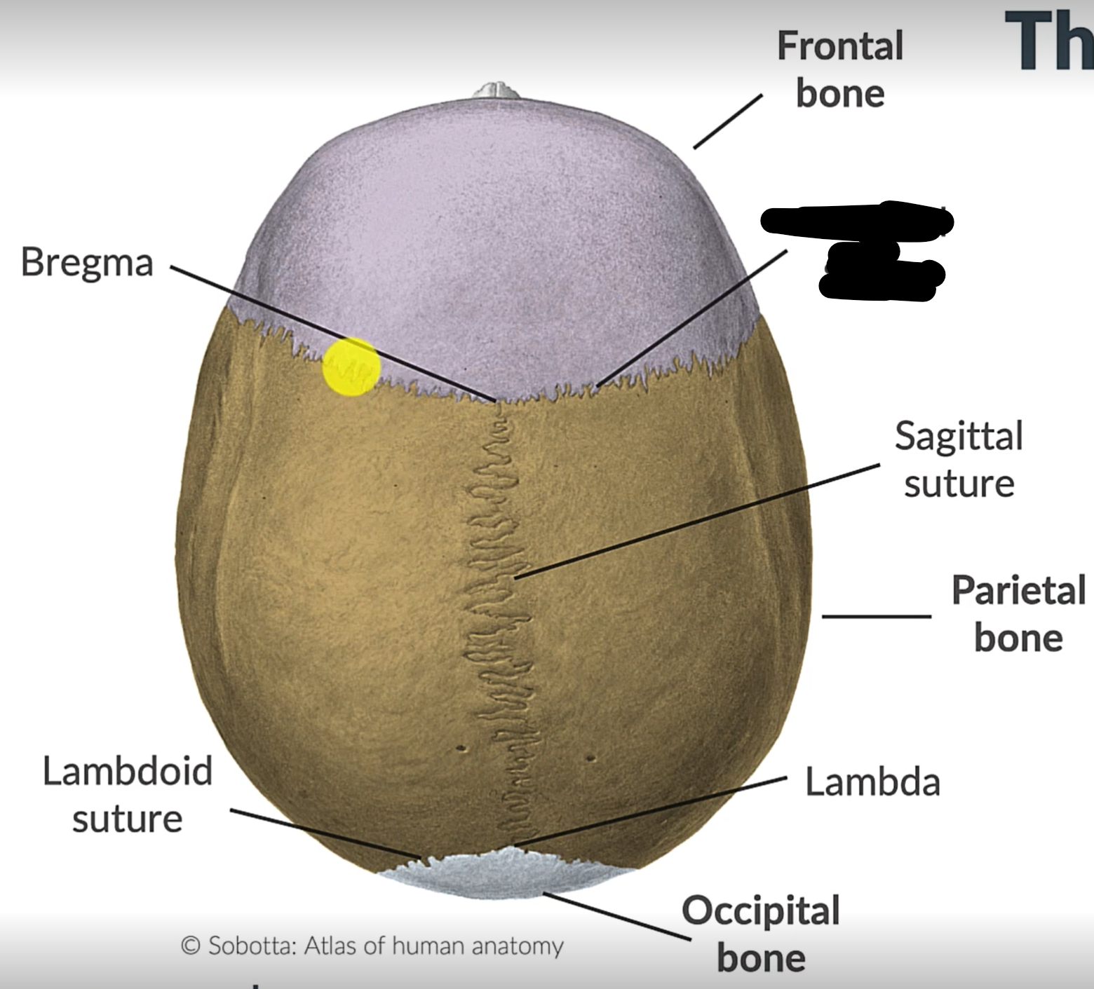 term image