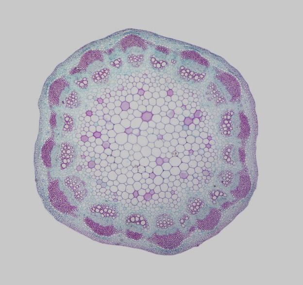 <p>The picture above is from the stem of a:</p><p>A. Monocot</p><p>B. Eudicot (i.e. dicot)</p><p>C. Both a dicot and a monocot</p><p>D. Neither a dicot or a monocot</p>