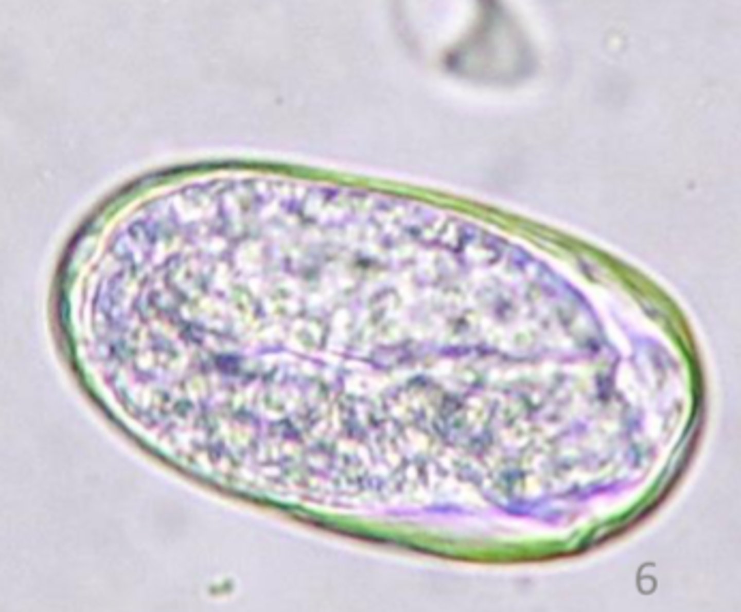 <p>What type of egg is found on this fecal float that is ~50 * 35 um?</p>
