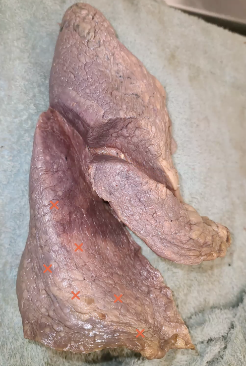<p>which lobe are these x’s on? </p>