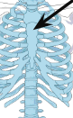 <p>breastbone</p>