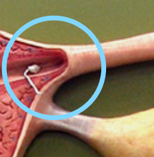 <p>Intramural part</p>