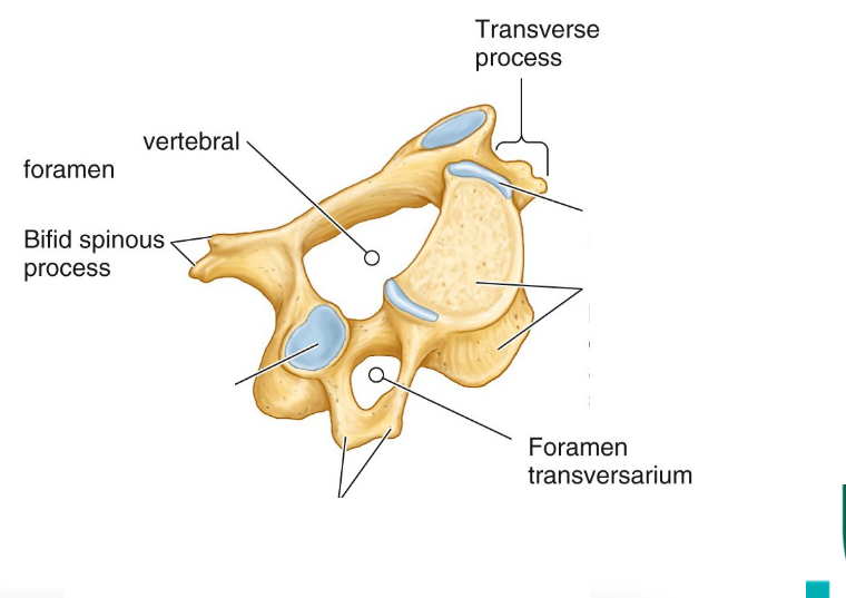 <ul><li><p>Small body</p></li><li><p>Transverse foramen found in the transverse process</p></li><li><p>Bifurcated spinous process</p></li></ul><p></p>