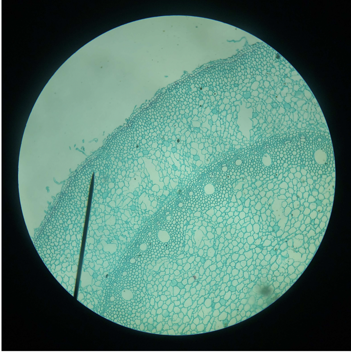 <p>Vascular Bundle</p><p></p>