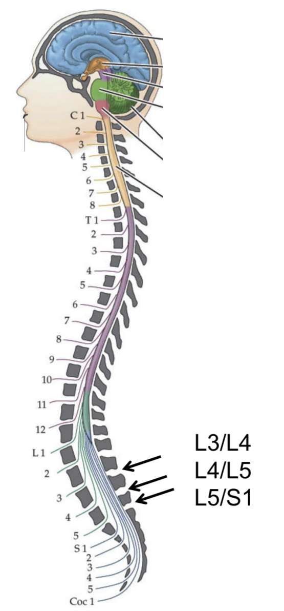 <ul><li><p>Collected via lumbar puncture (spinal tap)</p><ul><li><p>A needle is inserted between the 3rd, 4th, or 5th lumbar vertebrae (below the spinal cord’s end) into the subarachnoid space to withdraw CSF for analysis of cells, proteins, glucose, infections, or biomarkers </p></li></ul></li><li><p>Analysis detects meningitis, haemorrhage, MS, tumours</p></li></ul><p></p>