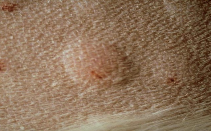 term image