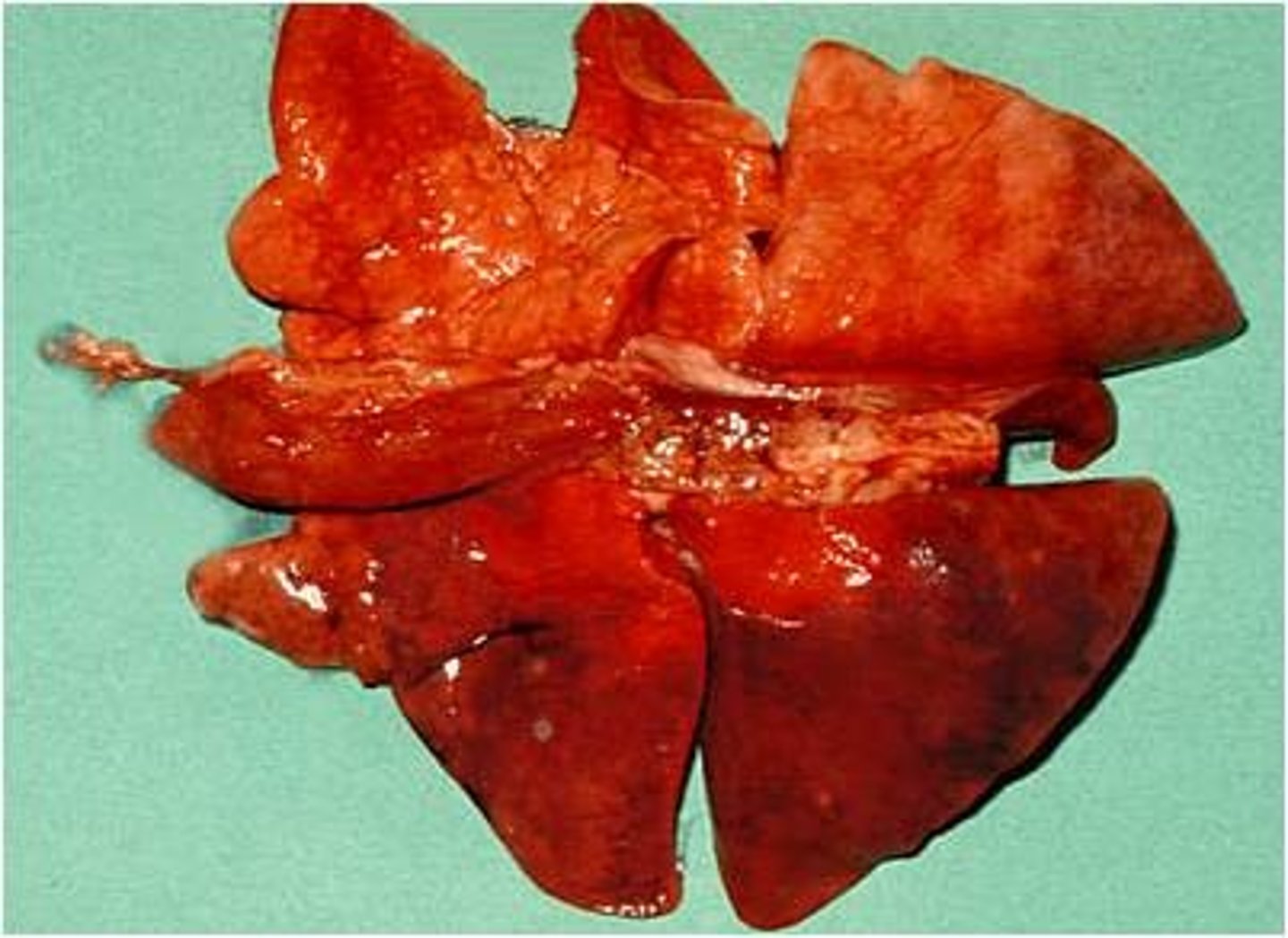 <p>To do with lungs can also be to do with air</p>