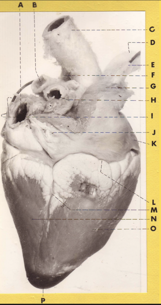 <p>B</p><p>(calf heart, atrial surface) 2 mo</p>