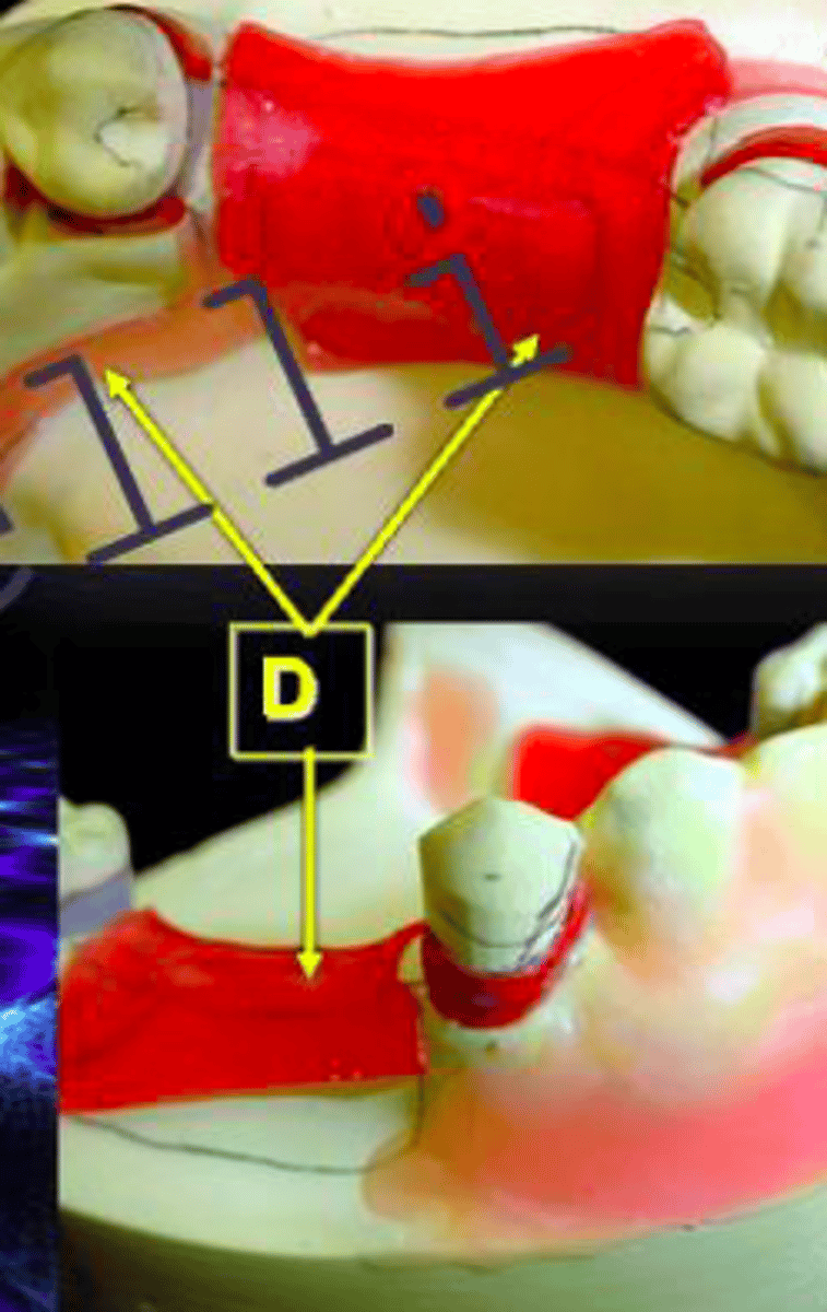 <p>ID the type of block out at D:</p>