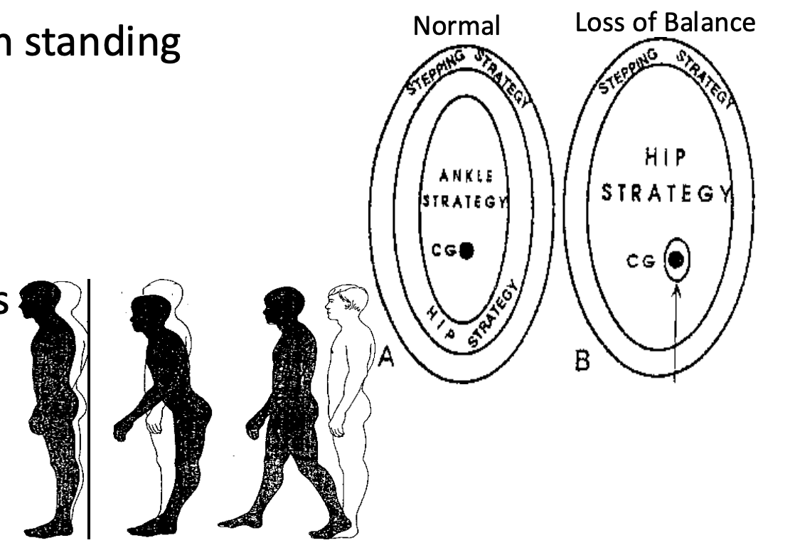 <ol><li><p><strong><u>Diagnosis</u></strong></p></li></ol><ul><li><p><em>e.g., stroke, TBI, MS, Guillain-Barré</em></p></li></ul><ol start="2"><li><p><strong><u>Goals of postural control in standing</u></strong></p></li><li><p><strong><u>Postural reactions</u></strong></p></li></ol><ul><li><p><strong><u>Restore equilibrium</u></strong> (i.e., <strong><u>getting your balance back</u></strong>)</p></li><li><p><strong><u>Synergistic movements</u></strong> (i.e., <strong><u>movements don’t occur in isolation</u></strong>; e.g., <em>hips and ankles will probably move at the same time when regaining balance</em>)</p></li><li><p><strong><u>Automaticity</u></strong> (i.e., <strong><u>restoring balance without being aware of doing it- subconsciously</u></strong>)</p></li></ul><ol start="4"><li><p><strong><u>Types of postural reactions</u></strong></p></li></ol><ul><li><p><strong><u>Ankle</u></strong></p><ul><li><p>a <strong><u>little sway to keep balance, with toes/heels pointing forward/back</u></strong></p></li></ul></li><li><p><strong><u>Hip</u></strong></p><ul><li><p><strong><u>coming forwards/backwards (flex/extend)</u></strong> and <strong><u>side-to-side</u></strong></p></li></ul></li><li><p><strong><u>Stepping</u></strong></p><ul><li><p><strong><u>increasing the base of support by widening</u></strong></p></li><li><p><em>e.g., taking a step when the subway gets you off balance&nbsp;</em></p></li></ul></li></ul><p></p>