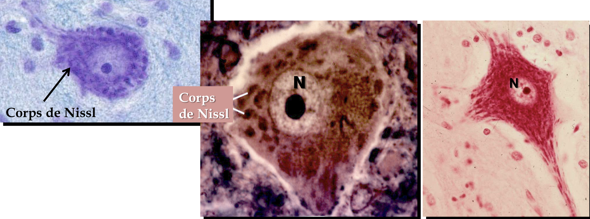 <p>-volume varie en fonction de l’activité du neurone</p><p>-aspect tigré disparait rapidement après énervation du neurone</p>