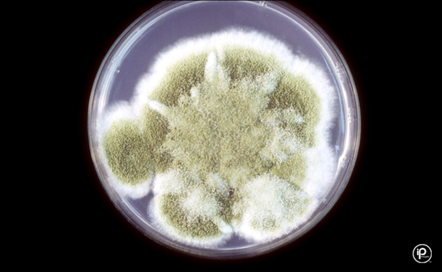 <p><em>Aspergillus flavus </em></p>