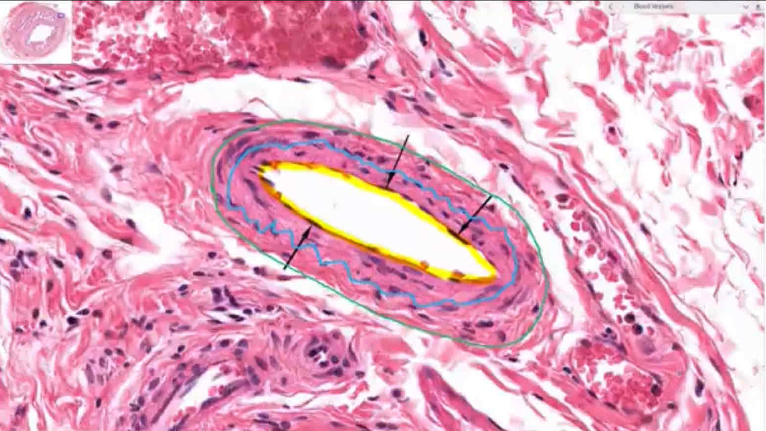 <p>Location of simple squamous epithelium</p>