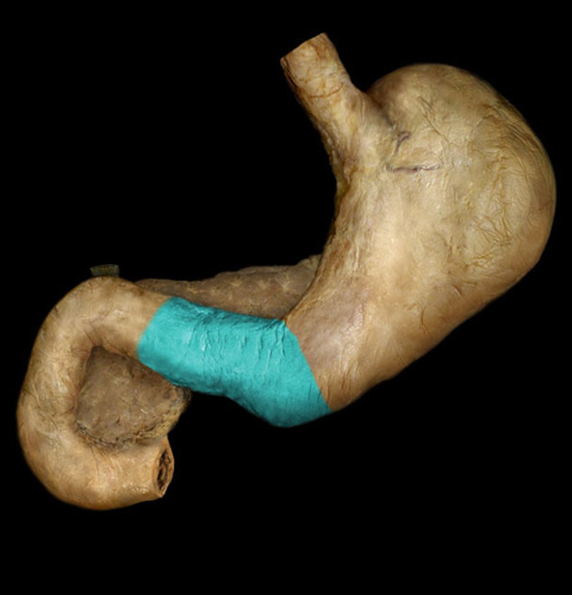 <p>what is highlighted in this image?</p>