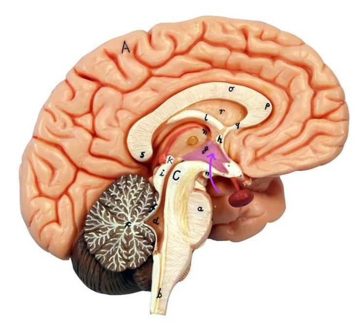 term image