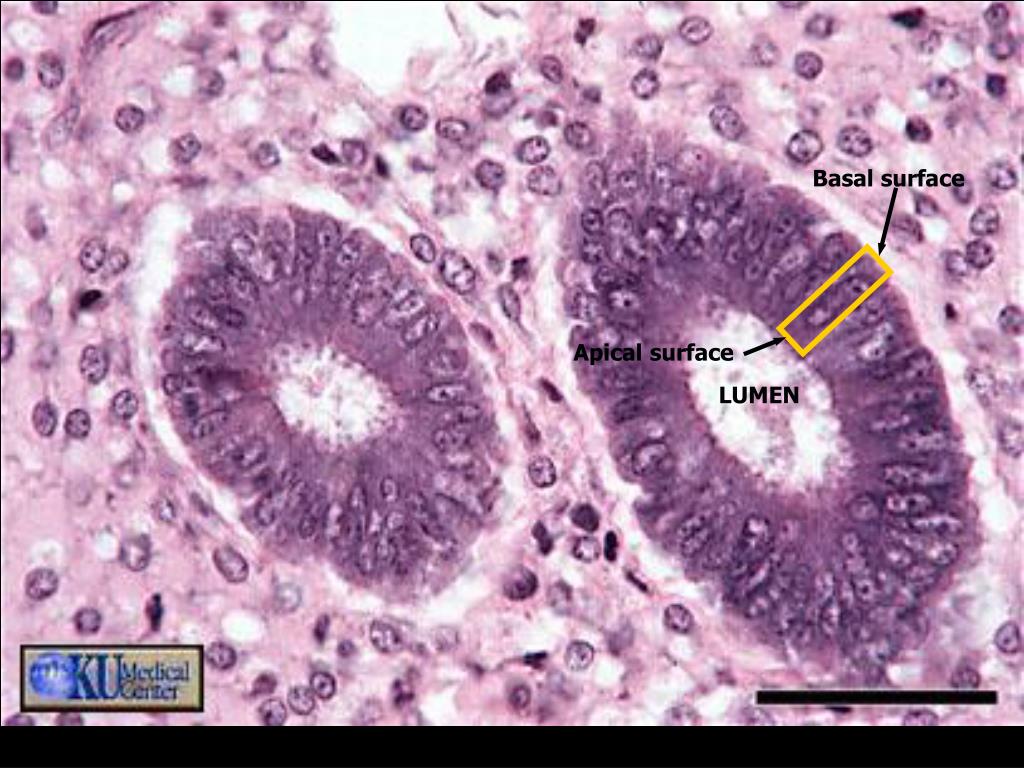 <p>The inner inside open space of a hollow organ/cavity or structure like intestines, blood vessels, or stomach</p><ul><li><p>pic: also on the white surface that is outside of all the purple (its zoomed in)</p></li></ul><p></p>