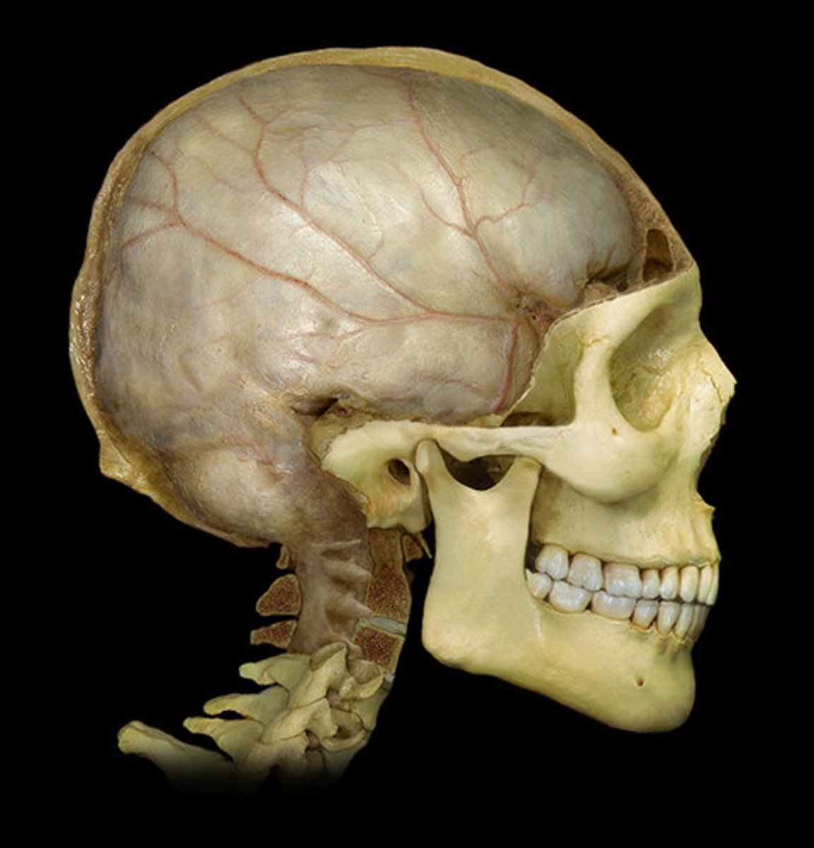 <p>-Layers separated by dural sinuses</p><p>-Pressed closely against cranial bones</p><p>=No epidural space</p><p>=Only attached to bone around foramen magnum, stella turcica, crista galli, and sutures of the skull</p>