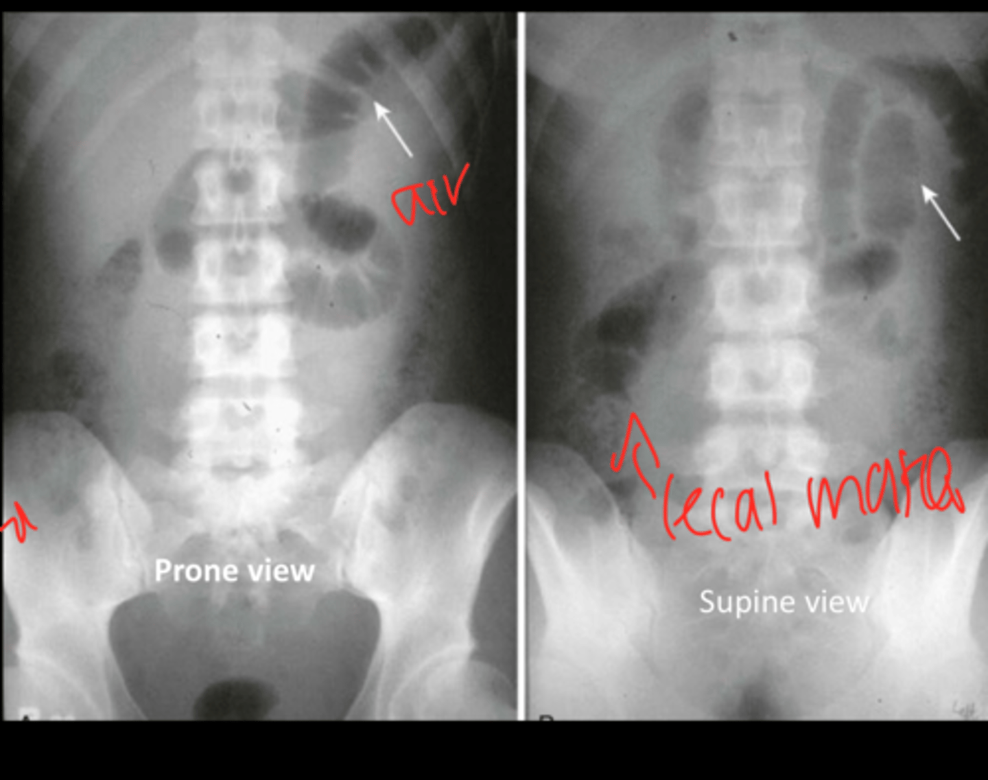 <p>what is this photo showing (two views here)</p>