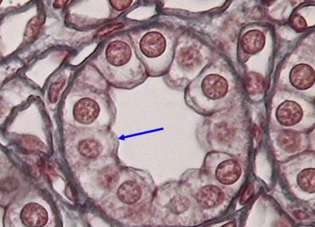 <p>What surface is the blue arrow pointing at?</p>