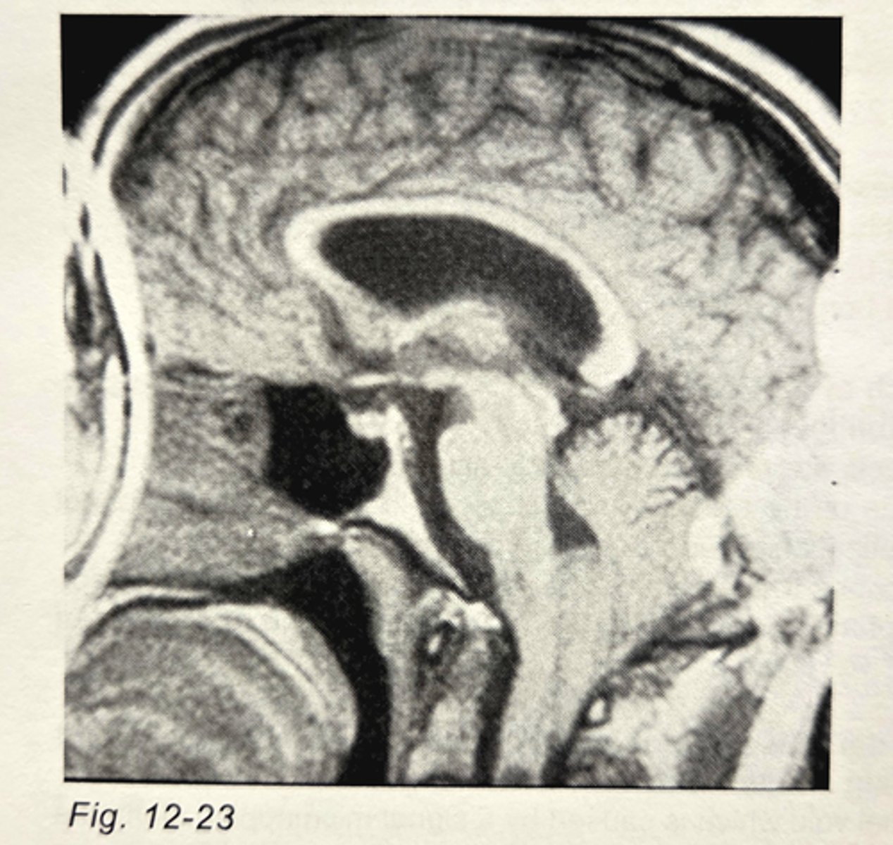 <p>no frequency wrap option</p><p>3 multiple choice options</p>
