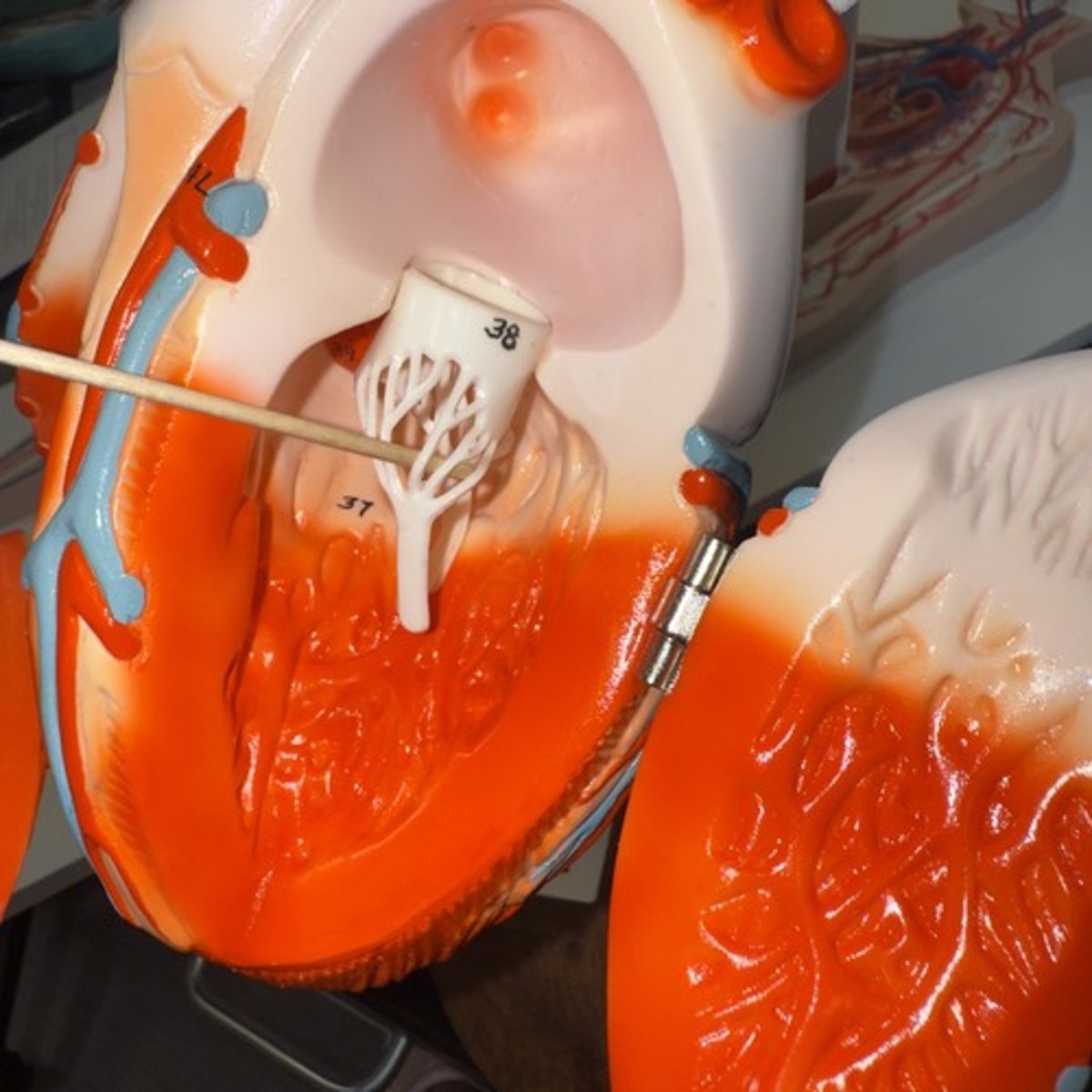 <p>Identify the structure.</p>