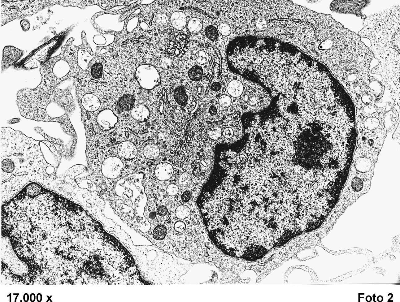 <ul><li><p>EM</p></li><li><p>kleurcontrast in coupes laag; visualisatie van cellen, celbestanddelen en extracellulair materiaal in weefsel</p></li><li><p>densiteitsverschillen verhogen = contrasteren</p></li><li><p>toevoegen van zware metalen → toename contrast</p><p></p></li><li><p>foto; cel uit het bloed (ingebed in hars; fixatie met OsO4; contrasteren met Ur-acetaat en Pb- citraat)</p></li></ul><p></p>