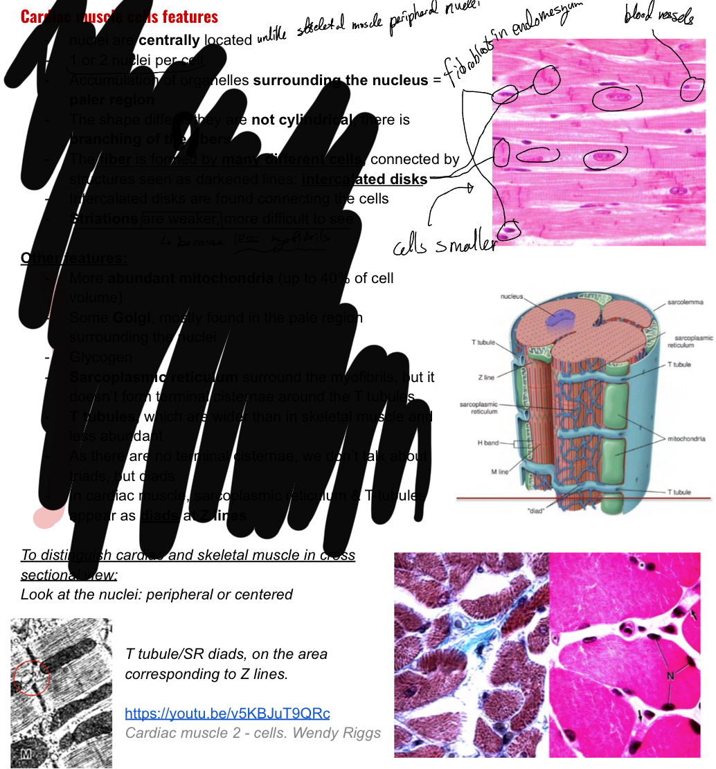 <ul><li><p>Striated</p></li><li><p>Self excitatory</p></li><li><p>Electrically coupled</p></li><li><p>Nuclei centrally located, multinucleated</p></li><li><p>Intercalated discs separate the cells and are seen as darker lines.</p></li><li><p>Striations are more difficult to see (weaker)</p></li><li><p>Have darker fibrolasts in endomesyum</p></li><li><p>Abudant mitochondria</p></li><li><p>Have diads instead of triads- sarcoplasmic reitculum and t tubules at z lines</p></li></ul><p></p>