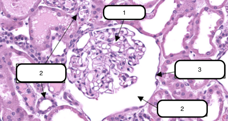 <p>In this slide, this is the ball-like structure made up of capillaries (glomerular capillaries), mesangial matrix (mesangium), and glomerular mesangial cells.</p>