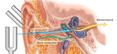 Auricle, ear canal, tympanic membrane