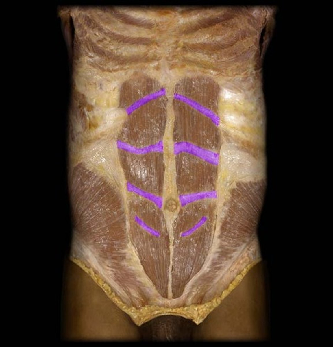 <p>They break the "six pack" muscle into segments.</p>