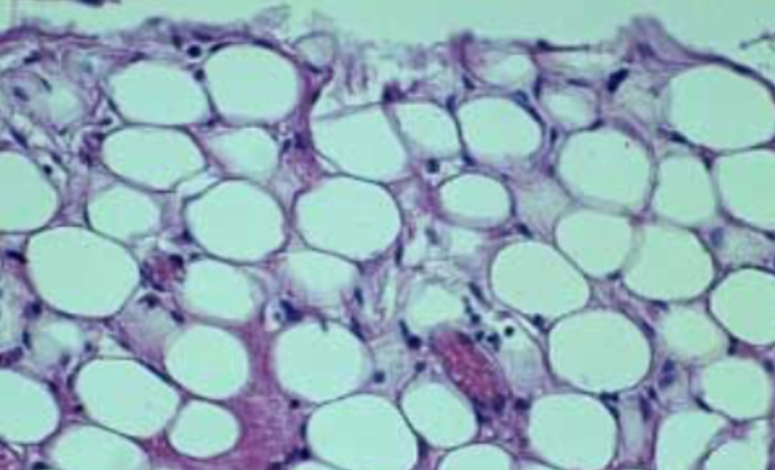 <p>Adipose (loose connective tissue)</p>