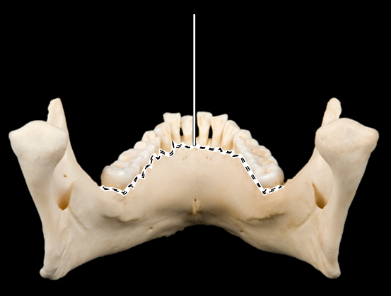 <p>Name the highlighted portion.</p><p>(Mandible, posterior view).</p>
