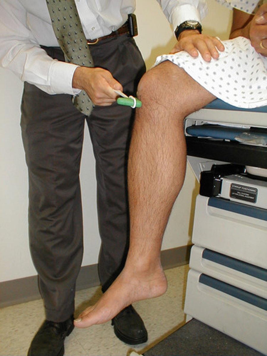 <p>-automatic contraction of the quadriceps in response to stretching of the patellar tendon<br>-artificially triggered by tapping patellar tendon</p>