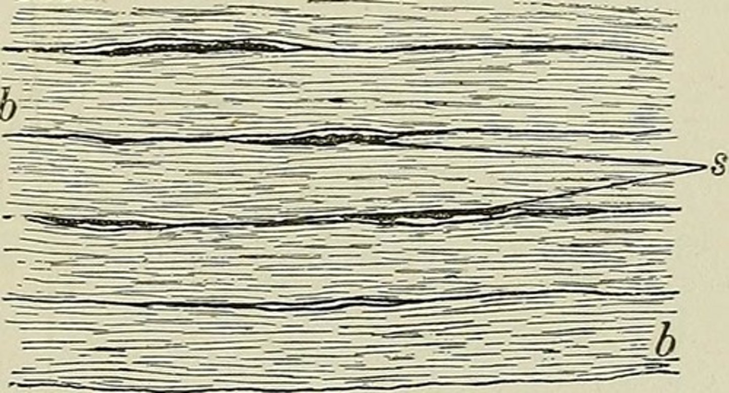 <p>connective tissue proper; dense connective tissue. tendons, most ligaments, aponeuroses.</p>