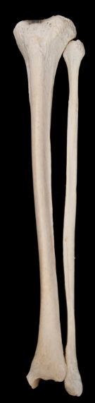 <p><span>Of these two bones, what is the medial bone called?</span></p>
