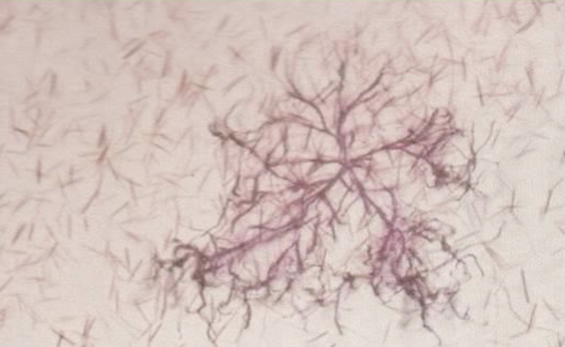 <ul><li><p>What is this?</p></li><li><p>What do we add to urine to make it this colour?</p></li></ul><p></p>