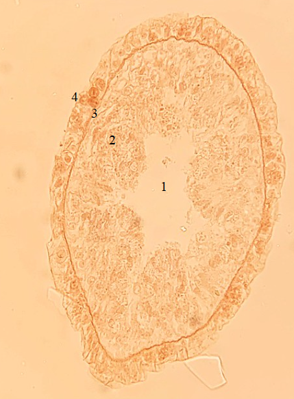 <p>Phylum?Class?<br>Symmetry? Tissue type? <br><br>1/2/3/4?</p>